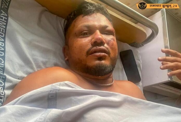 अहमदाबाद विमान हादसा: आग से पहले रमेश ने दिखाई बहादुरी, कूदकर बचाई जान